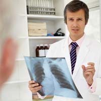 Clinical Trial May be Best Second-Line Approach for Mesothelioma