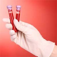 2516827_blood test