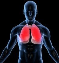 The Link Between Pleural Plaques and Mesothelioma