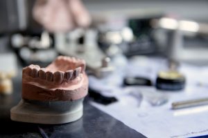 Dental Technicians May Be at Increased Risk for Malignant Mesothelioma