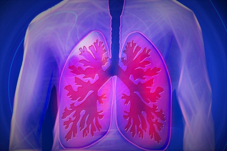 Recurring Collapsed Lung as an Early Indicator of Malignant Mesothelioma