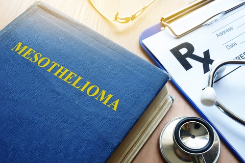 Mesothelioma Incidence in the US: The Good News and the Bad News