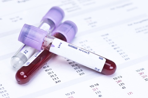 Revolutionizing Mesothelioma Diagnosis: Breakthrough Blood Test Method