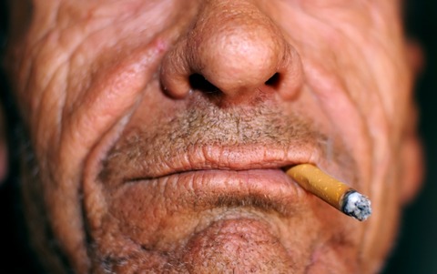 Age and Smoking Less Important Than Other Factors for Mesothelioma Outcomes