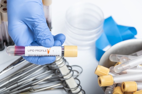 Could Lipids Hold the Key to Improving the Mesothelioma Diagnostic Process?